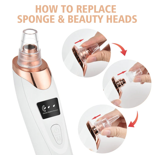 5-in-1 LED Blackhead Suction Device for Deep Pore Cleansing
